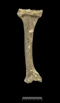 Egypt Prints: Tibia of Achondroplastic Dwarf
