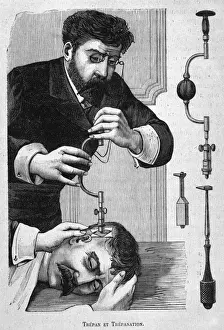 Surgery Prints: Trepanner on the Job