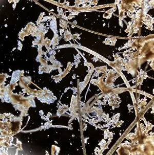 Trichinella spiralis, parasitic roundworm