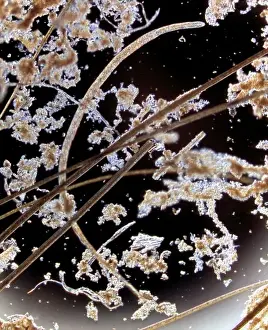Parasite Prints: Trichinella spiralis, parasitic roundworm