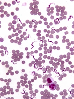 Protozoa Collection: Trypanosomes