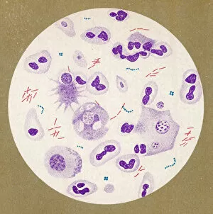 Tuberculosis Collection: Tuberculosis Bacillus