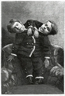 Controls Collection: Two-Headed Boy