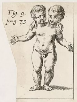 Two-Headed Child / 1691