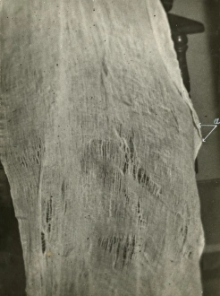 Sance Gallery: Undated photograph of enlarged portion of ectoplasm