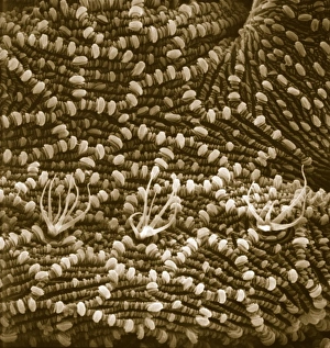 Acarina Gallery: Ventral surface of a mite from the prostigmatic species