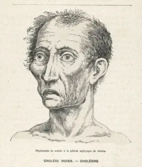 Plagues Prints: VICTIM OF CHOLERA / 1883
