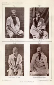 Salpetriere Prints: VICTIMS OF HASHISH