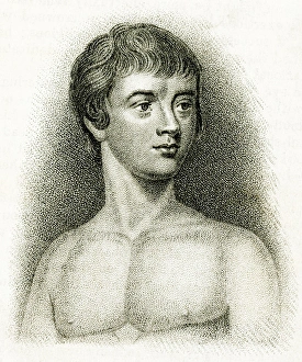 Physician Gallery: Victor, feral child