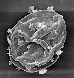 Scanning Electron Micrograph Collection: Visbyshaera oligofurcata, acritarch