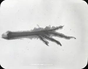 X Rays Prints: X-Ray - Claw foot