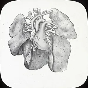 X Rays Prints: X-Ray - Heart and Lungs