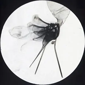 X Rays Prints: X-Ray - Honey Bee Sting