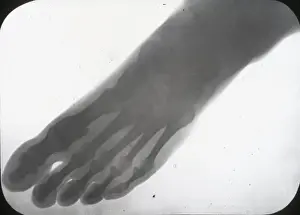 X Rays Prints: X-Ray - Human Foot