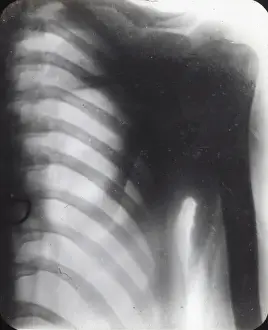 X Rays Prints: X-Ray - Human Male Chest