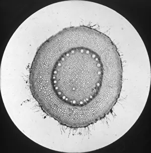 X Rays Prints: X-Ray - Internal structire of a plant cell