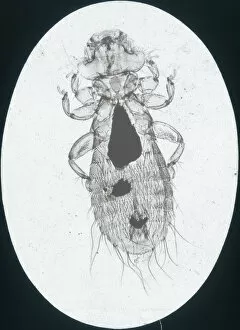 Microscopic Collection: X-Ray - Microscopic x-ray view of a small head louse