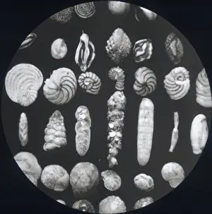 X Rays Prints: X-Ray - Parasite Specimens