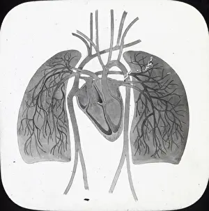 X Rays Prints: X-Ray - Pulmonary Circulation
