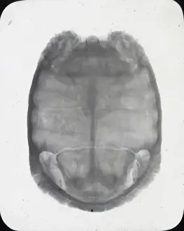 X Rays Prints: X-Ray - Showing Skeleton of Tortoise
