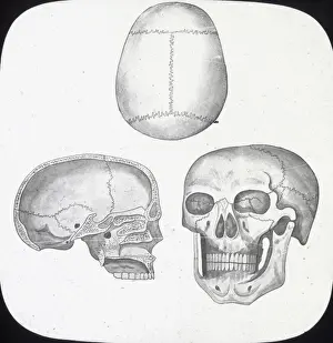X Rays Prints: X-Ray - Skull, Front, Top-and Section