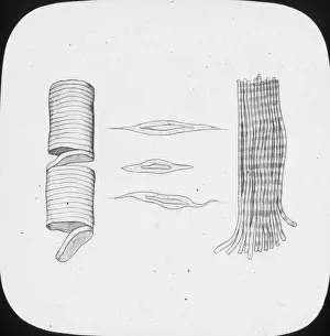 X Rays Prints: X-Ray - Voluntary and Involuntary Muscular Fibres