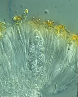 Microscopic Collection: Xanthoria parietina, lichen